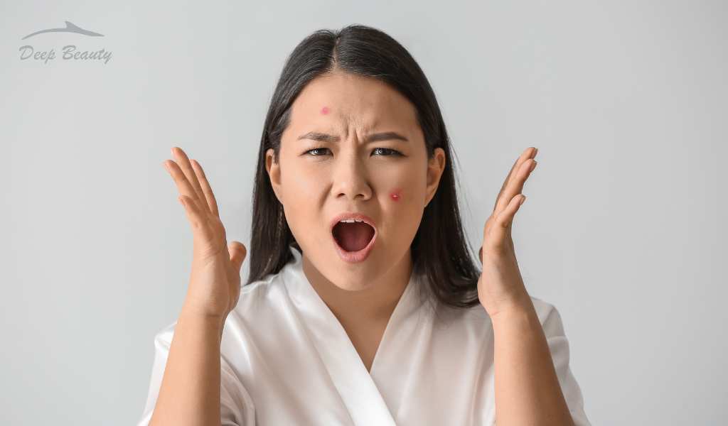 cara menghilangkan jerawat batu